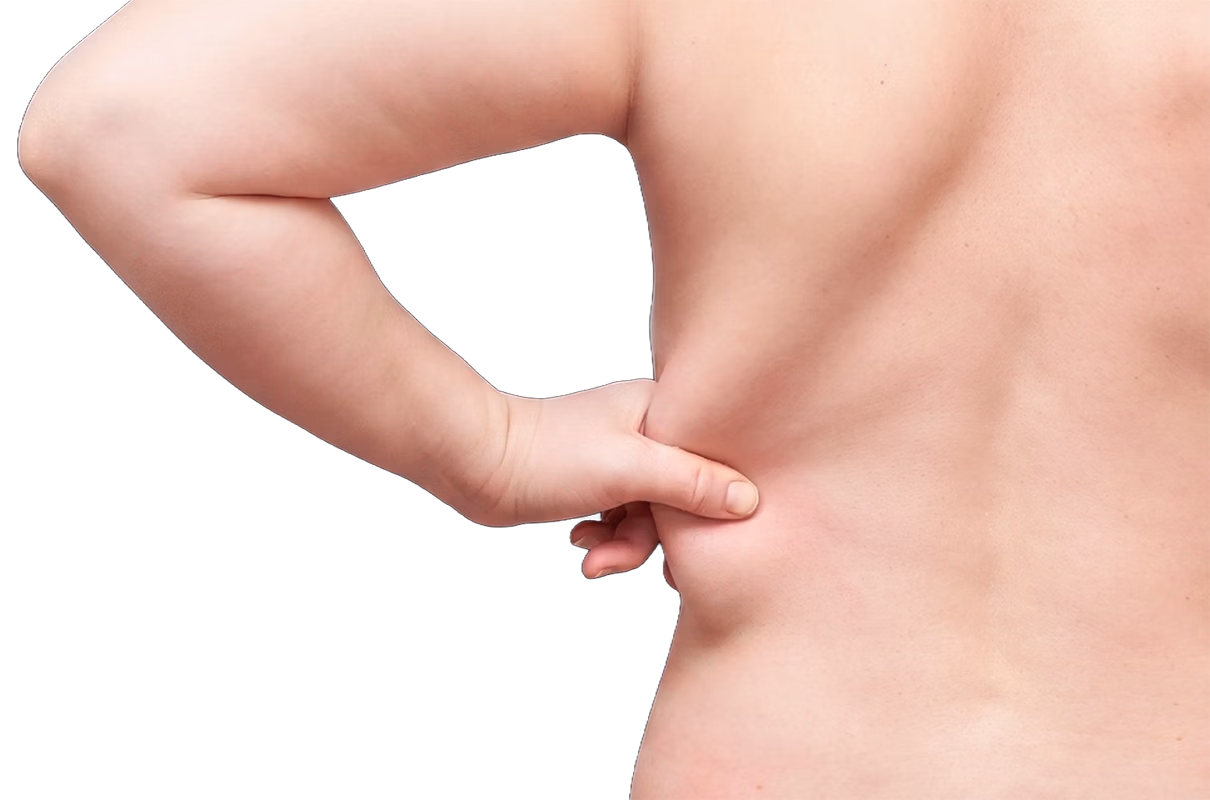 Balmori Center - Servicios - GORDITOS EN ESPALDA Y ABDOMEN