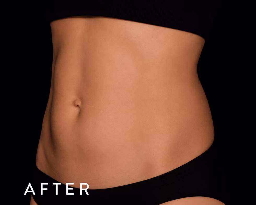 Balmori Center - MARCAR ABDOMEN, EMSCULPT CLÁSICO
