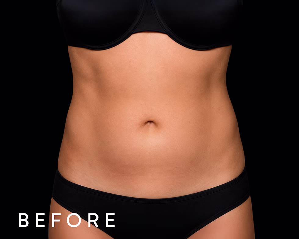 Balmori Center - MARCAR ABDOMEN, EMSCULPT CLÁSICO