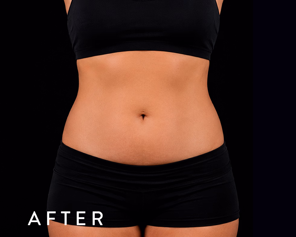 Toned midsection of a woman in black athletic wear with the word AFTER in the corner, suggesting transformation/progress photos.