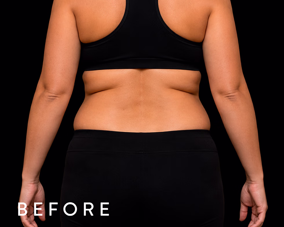Back view of a person in a black sports bra and leggings, showing mid-back fat rolls; labeled 'BEFORE' for a fitness transformation image.