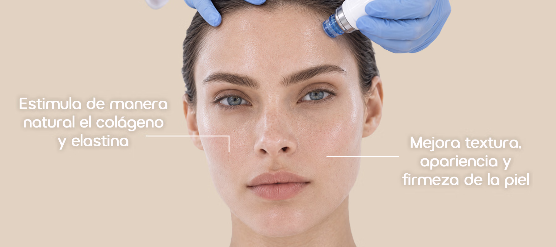 Dermapen (microneedling) en Polanco CDMX Aparatología - Balmori Center